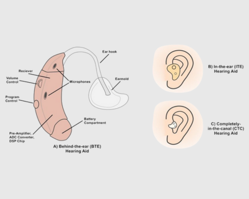 Behind the ear (BTE)