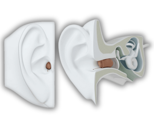 hearing aid specialist